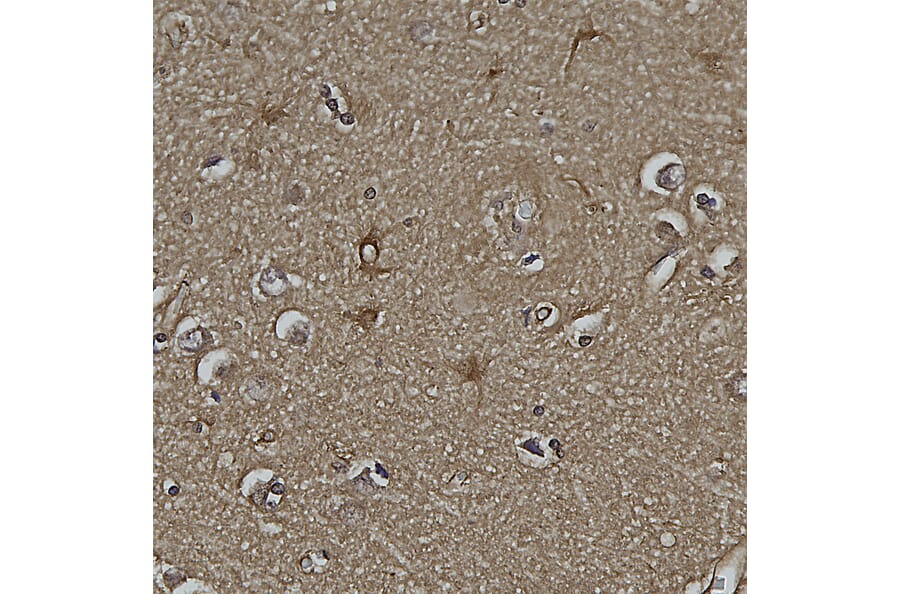Immunohistochemistry - Anti-DJ1 Antibody [4H4] (A85343) - Antibodies.com