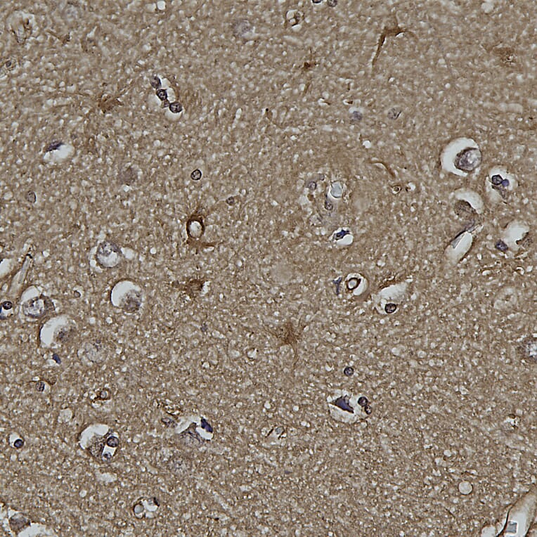 Immunohistochemistry - Anti-DJ1 Antibody [4H4] (A85343) - Antibodies.com