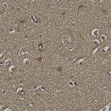 Immunohistochemistry - Anti-DJ1 Antibody [4H4] (A85343) - Antibodies.com