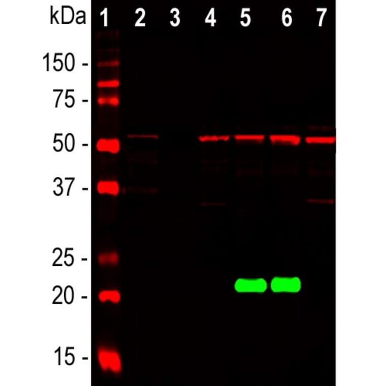 Western Blot - Anti-DJ1 Antibody (A85343) - Antibodies.com