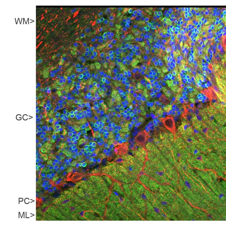 Immunofluorescence - Anti-Visinin Like Protein 1 Antibody (A85344) - Antibodies.com