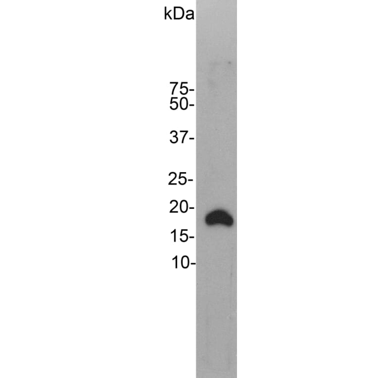 Western Blot - Anti-Visinin Like Protein 1 Antibody (A85344) - Antibodies.com