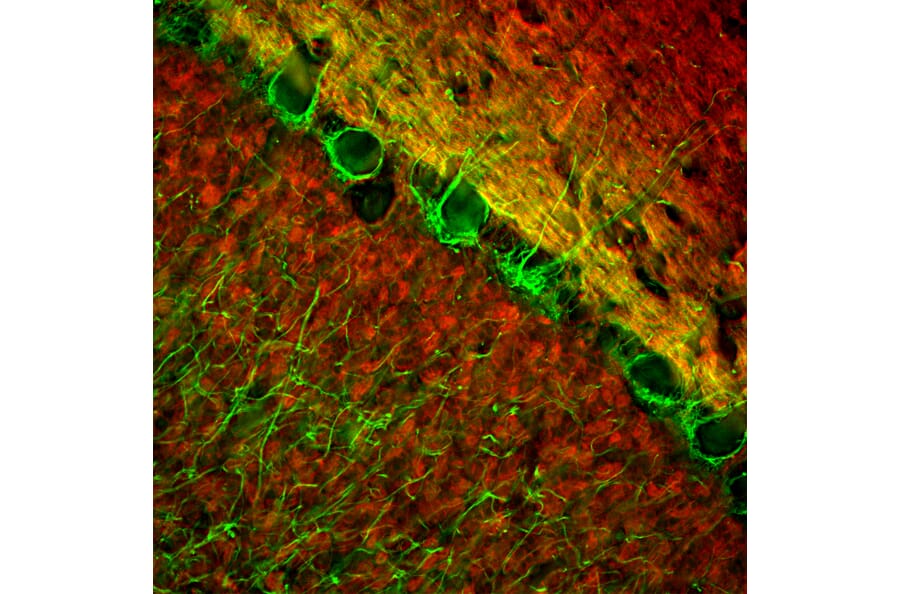 Immunofluorescence - Anti-Visinin Like Protein 1 Antibody (A85344) - Antibodies.com