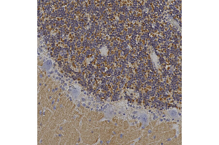 Immunohistochemistry - Anti-Visinin Like Protein 1 Antibody (A85344) - Antibodies.com