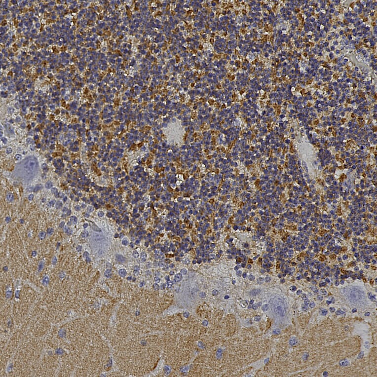 Immunohistochemistry - Anti-Visinin Like Protein 1 Antibody (A85344) - Antibodies.com