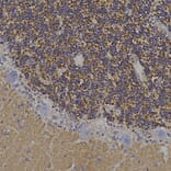 Immunohistochemistry - Anti-Visinin Like Protein 1 Antibody (A85344) - Antibodies.com