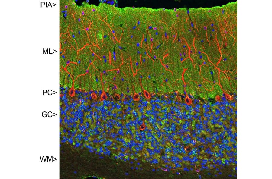Immunofluorescence - Anti-Visinin Like Protein 1 Antibody [2D11] (A85345) - Antibodies.com