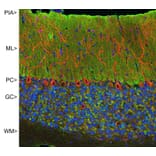 Immunofluorescence - Anti-Visinin Like Protein 1 Antibody (A85345) - Antibodies.com