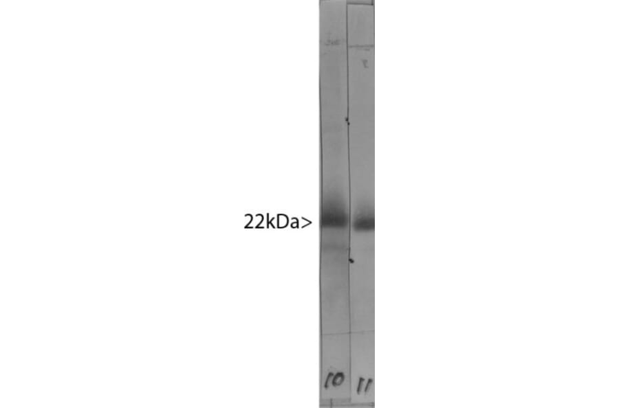 Western Blot - Anti-Visinin Like Protein 1 Antibody [2D11] (A85345) - Antibodies.com