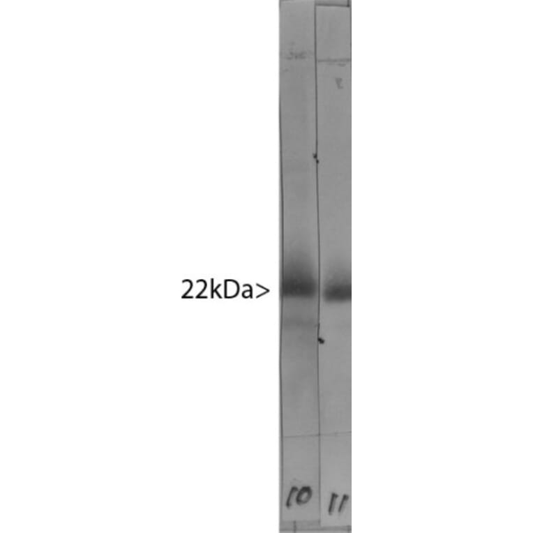 Western Blot - Anti-Visinin Like Protein 1 Antibody (A85345) - Antibodies.com