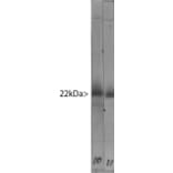 Western Blot - Anti-Visinin Like Protein 1 Antibody (A85345) - Antibodies.com