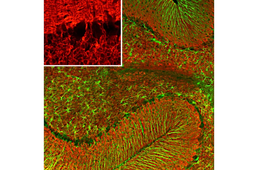 Immunofluorescence - Anti-Visinin Like Protein 1 Antibody [2D11] (A85345) - Antibodies.com