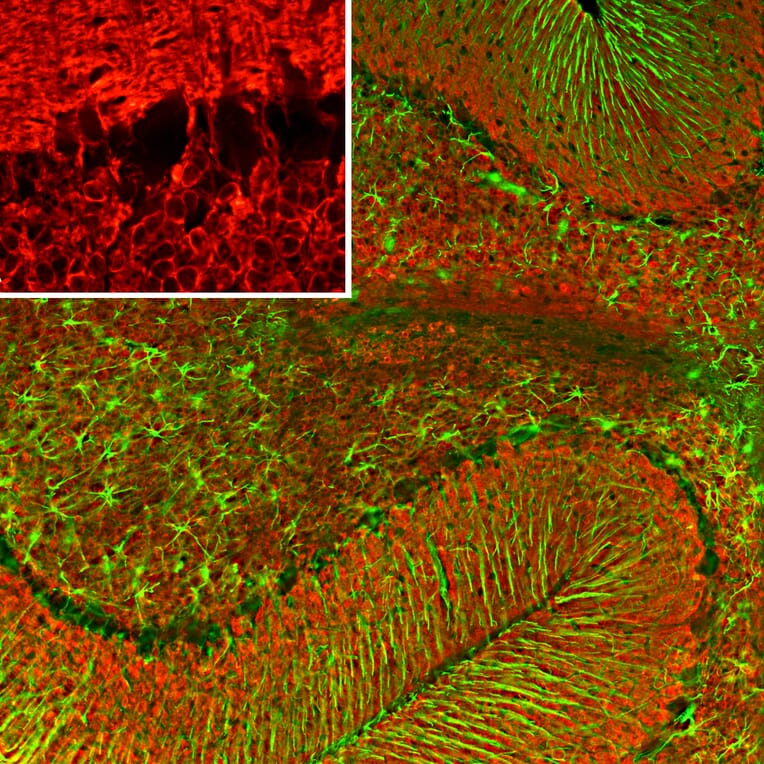 Immunofluorescence - Anti-Visinin Like Protein 1 Antibody [2D11] (A85345) - Antibodies.com