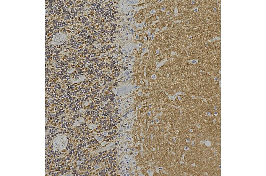 Immunohistochemistry - Anti-Visinin Like Protein 1 Antibody [2D11] (A85345) - Antibodies.com