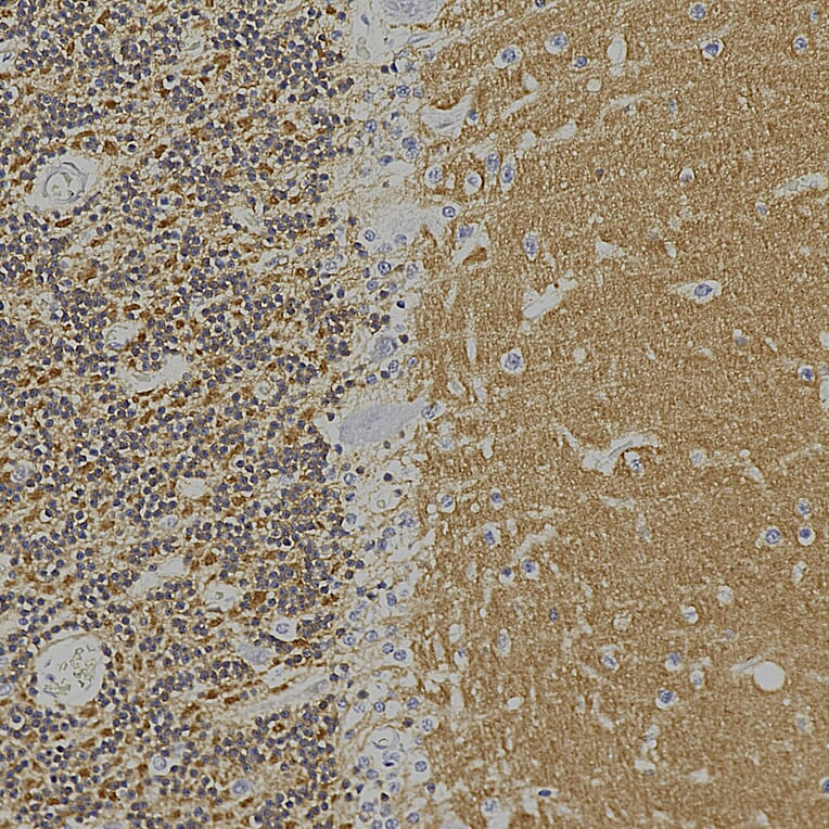 Immunohistochemistry - Anti-Visinin Like Protein 1 Antibody [2D11] (A85345) - Antibodies.com