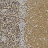 Immunohistochemistry - Anti-Visinin Like Protein 1 Antibody [2D11] (A85345) - Antibodies.com