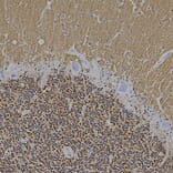 Immunohistochemistry - Anti-Visinin Like Protein 1 Antibody [3A9] (A85346) - Antibodies.com