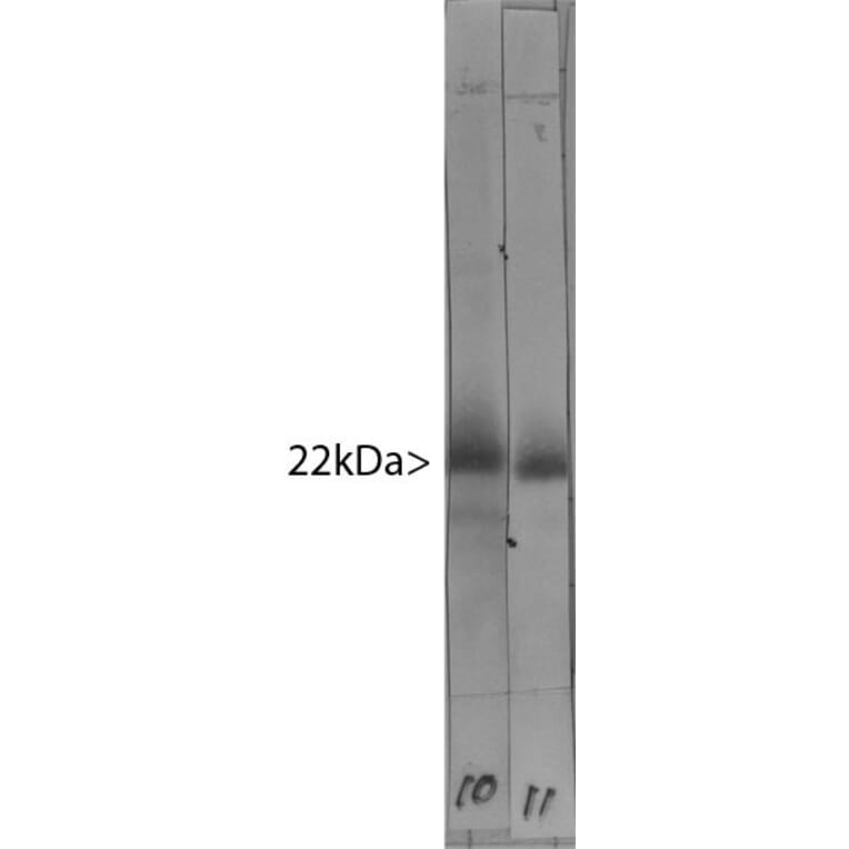 Western Blot - Anti-Visinin Like Protein 1 Antibody [3A9] (A85346) - Antibodies.com