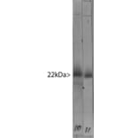 Western Blot - Anti-Visinin Like Protein 1 Antibody [3A9] (A85346) - Antibodies.com