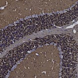 Immunohistochemistry - Anti-Visinin Like Protein 1 Antibody (A85347) - Antibodies.com