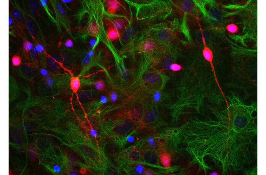 Immunofluorescence - Anti-Visinin Like Protein 1 Antibody (A85347) - Antibodies.com