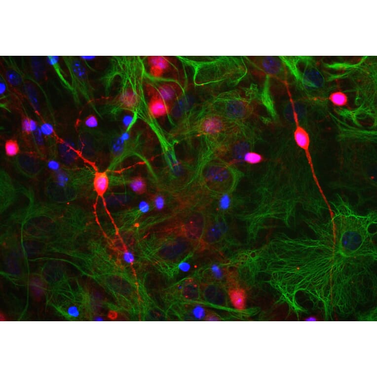 Immunofluorescence - Anti-Visinin Like Protein 1 Antibody (A85347) - Antibodies.com