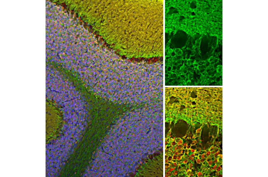Immunofluorescence - Anti-Visinin Like Protein 1 Antibody (A85347) - Antibodies.com