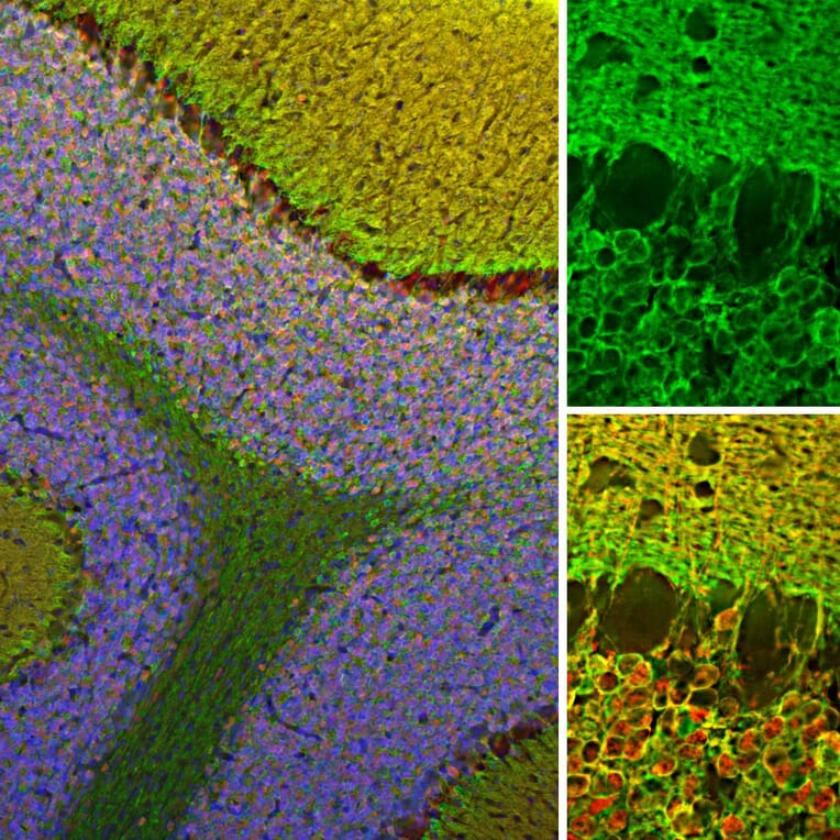 Immunofluorescence - Anti-Visinin Like Protein 1 Antibody (A85347) - Antibodies.com