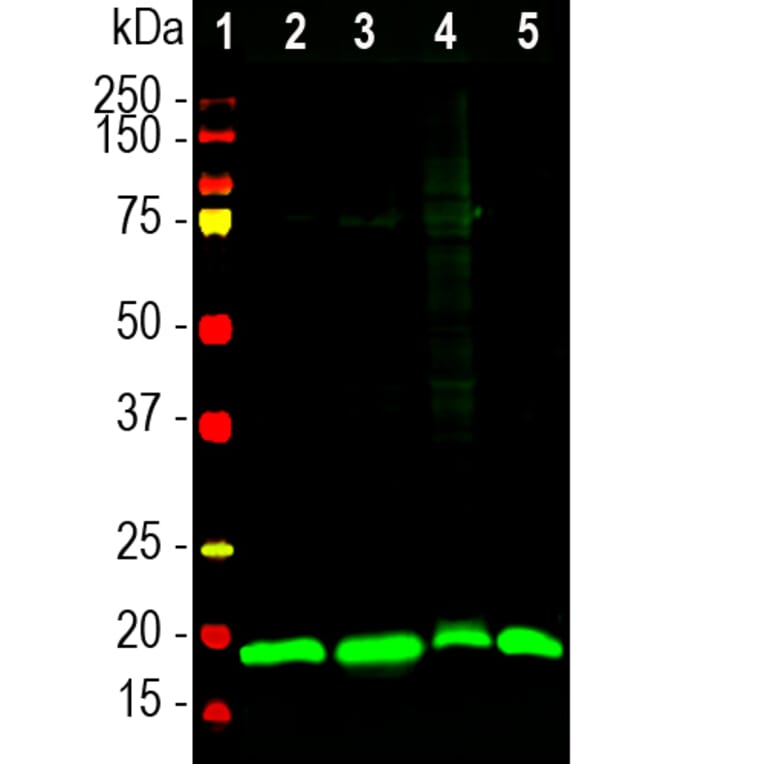 Western Blot - Anti-Visinin Like Protein 1 Antibody (A85347) - Antibodies.com