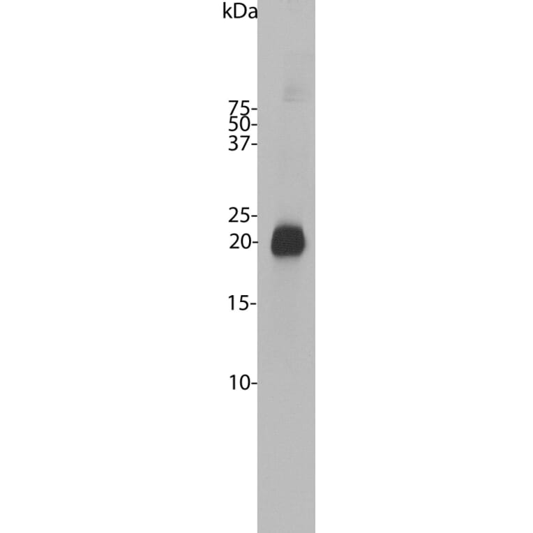 Western Blot - Anti-Visinin Like Protein 1 Antibody (A85347) - Antibodies.com