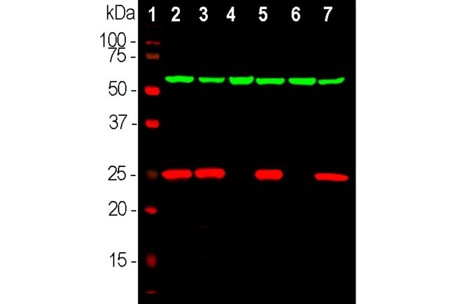 Western Blot - Anti-UCHL1 Antibody (A85348) - Antibodies.com
