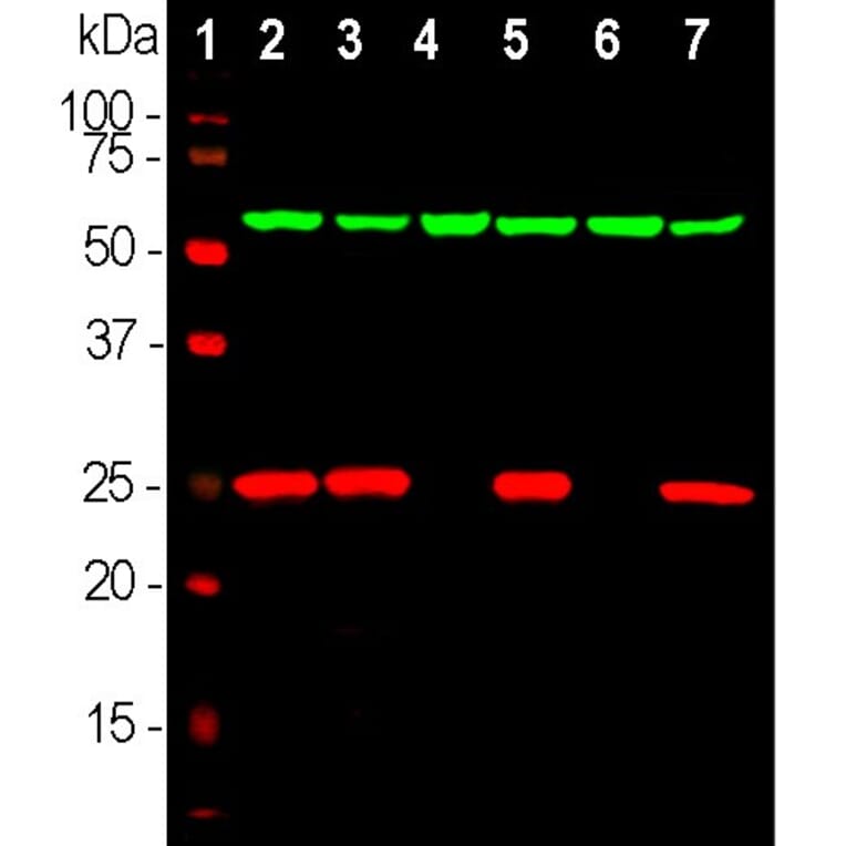 Western Blot - Anti-UCHL1 Antibody (A85348) - Antibodies.com