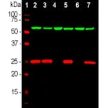 Western Blot - Anti-UCHL1 Antibody (A85348) - Antibodies.com