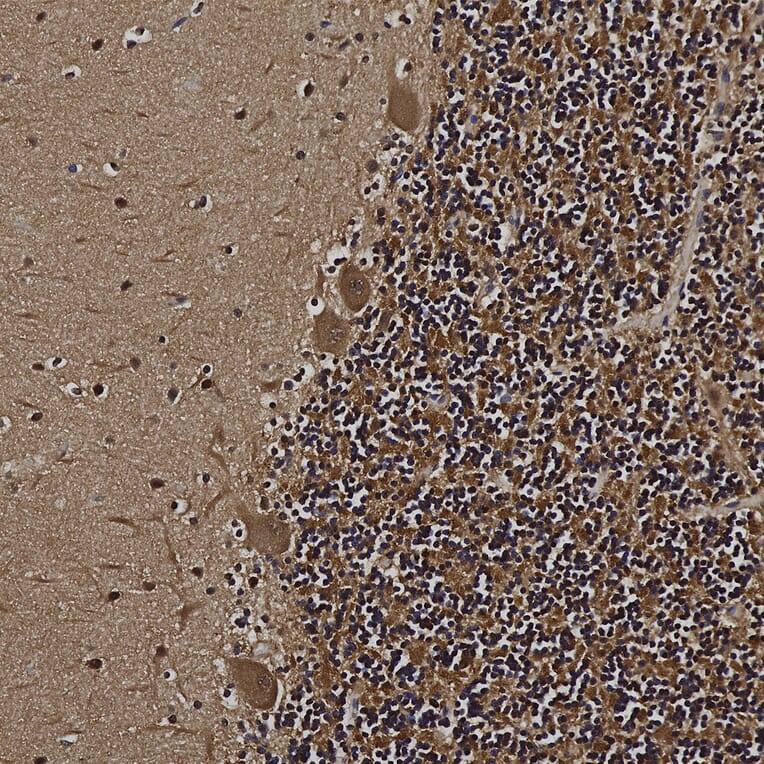 Immunohistochemistry - Anti-UCHL1 Antibody (A85348) - Antibodies.com