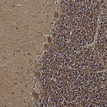 Immunohistochemistry - Anti-UCHL1 Antibody (A85348) - Antibodies.com