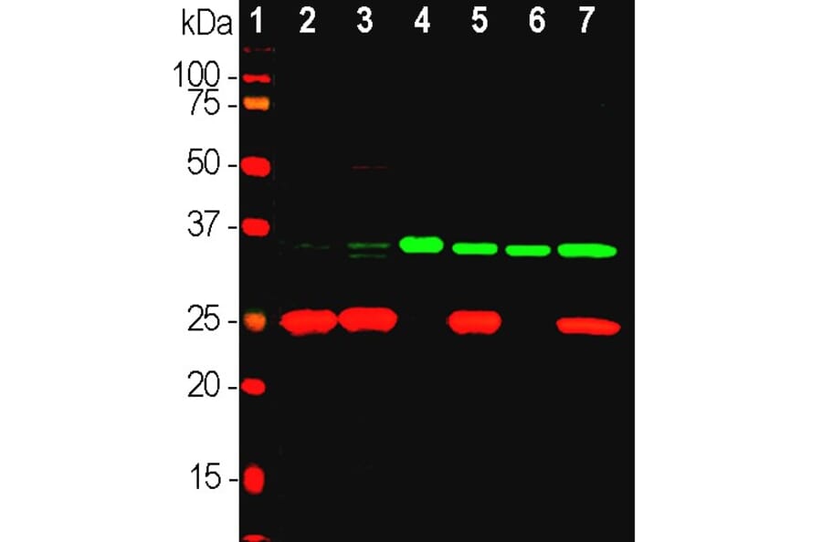 Western Blot - Anti-UCHL1 Antibody (A85348) - Antibodies.com