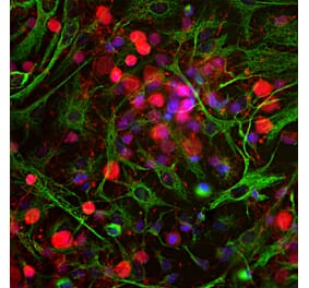 Immunofluorescence - Anti-UCHL1 Antibody (A85349) - Antibodies.com