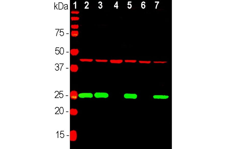 Western Blot - Anti-UCHL1 Antibody (A85349) - Antibodies.com