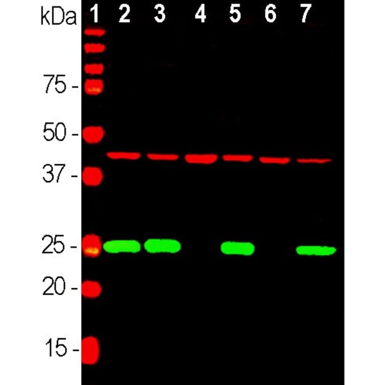 Western Blot - Anti-UCHL1 Antibody (A85349) - Antibodies.com