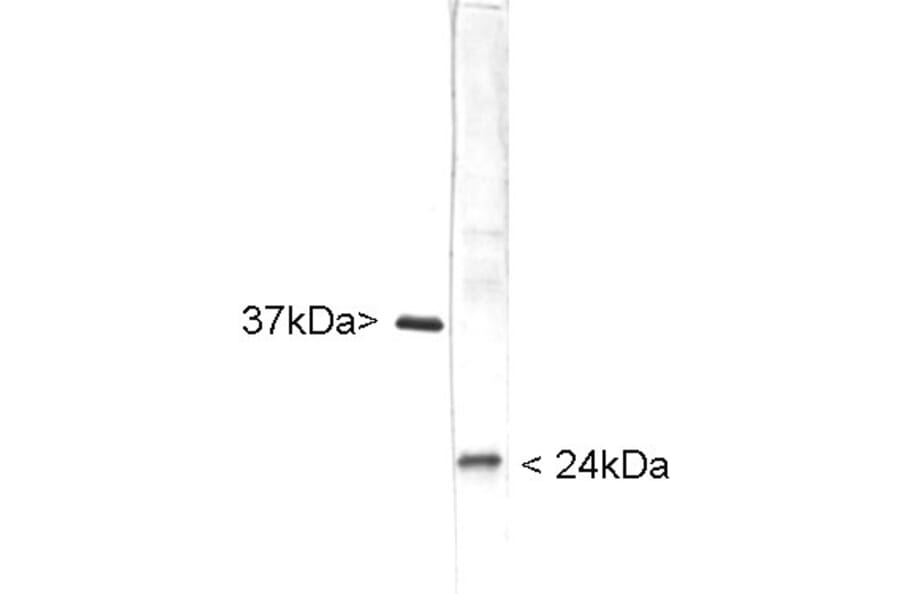Western Blot - Anti-UCHL1 Antibody (A85349) - Antibodies.com