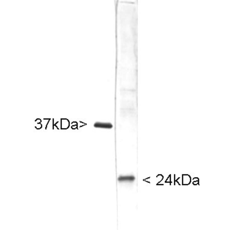 Western Blot - Anti-UCHL1 Antibody (A85349) - Antibodies.com