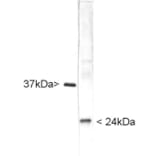 Western Blot - Anti-UCHL1 Antibody (A85349) - Antibodies.com