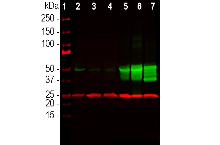 Western Blot - Anti-UCHL1 Antibody (A85349) - Antibodies.com