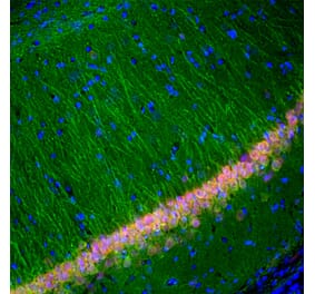 Immunofluorescence - Anti-UCH-L1 Antibody [BH7] (A85351) - Antibodies.com