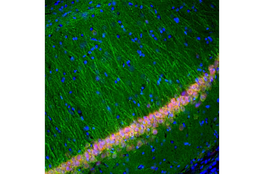 Immunofluorescence - Anti-UCHL1 Antibody [BH7] (A85351) - Antibodies.com