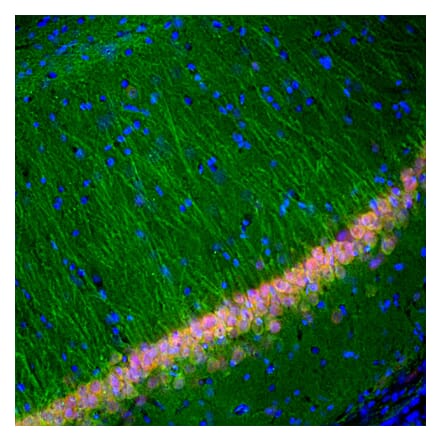 Immunofluorescence - Anti-UCH-L1 Antibody [BH7] (A85351) - Antibodies.com