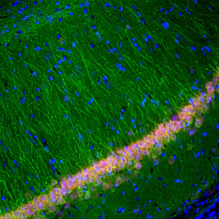 Immunofluorescence - Anti-UCH-L1 Antibody [BH7] (A85351) - Antibodies.com