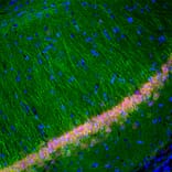 Immunofluorescence - Anti-UCH-L1 Antibody [BH7] (A85351) - Antibodies.com