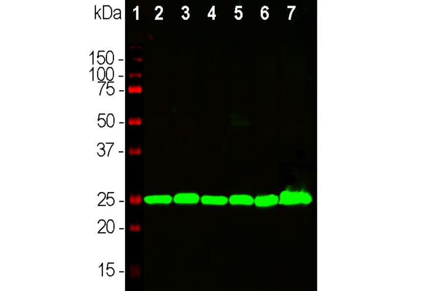 Western Blot - Anti-UCHL1 Antibody [BH7] (A85351) - Antibodies.com