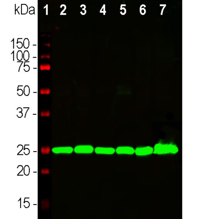 Western Blot - Anti-UCH-L1 Antibody [BH7] (A85351) - Antibodies.com